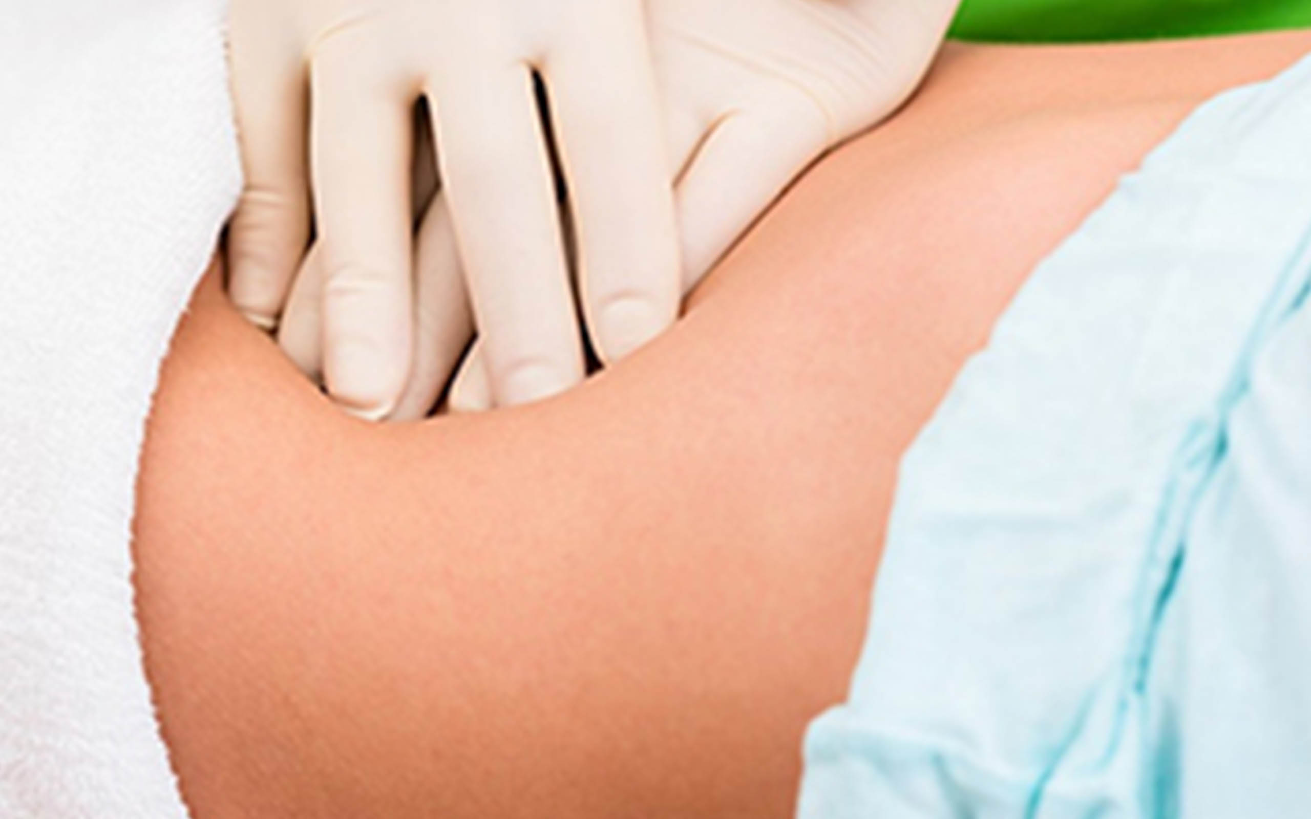 Kolon Klinzing Therapy