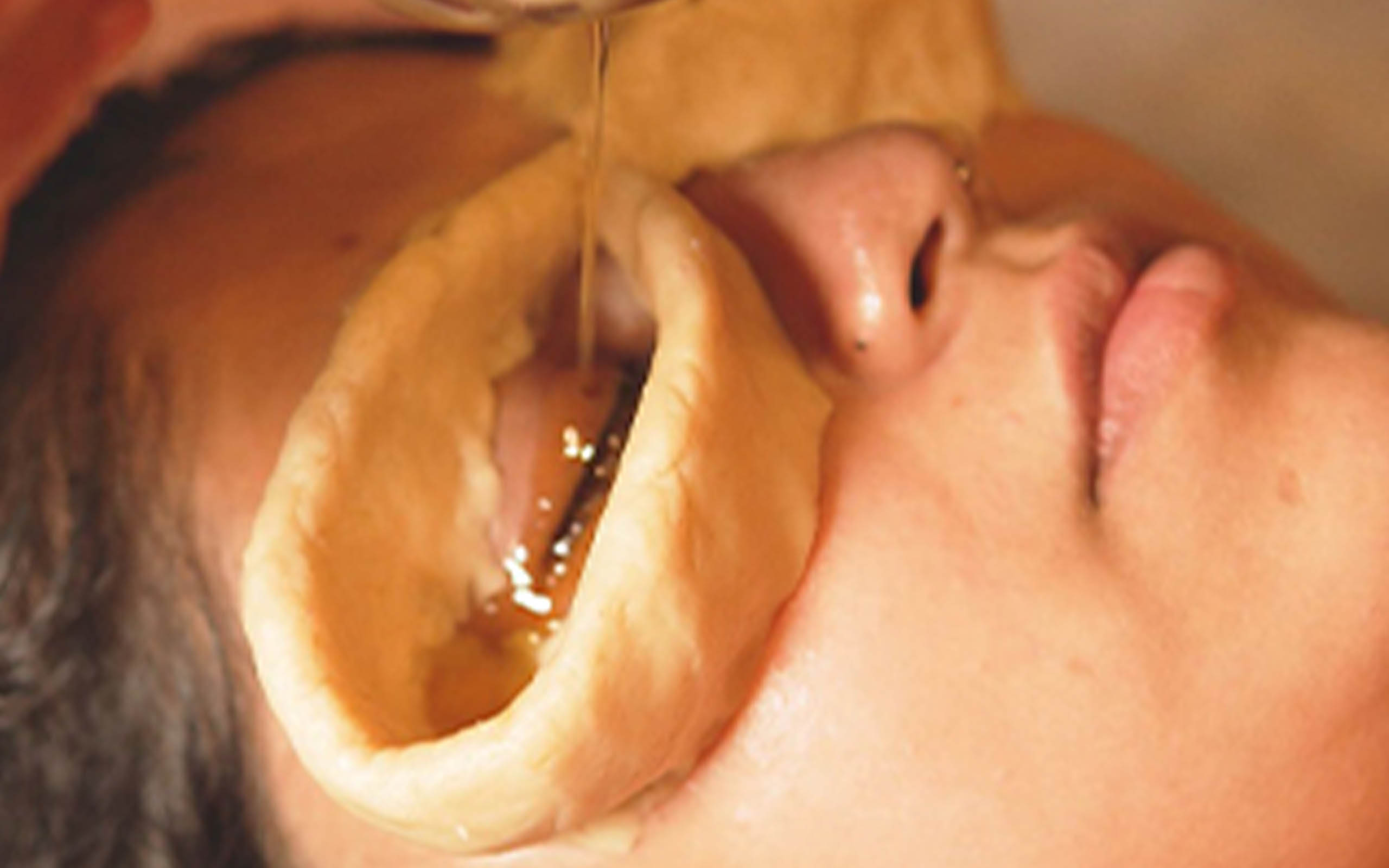 Akshay Tarpan Therapy